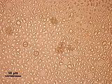 12 -  Visione superficiale di un tetrasporofito con tetrasporocisti
